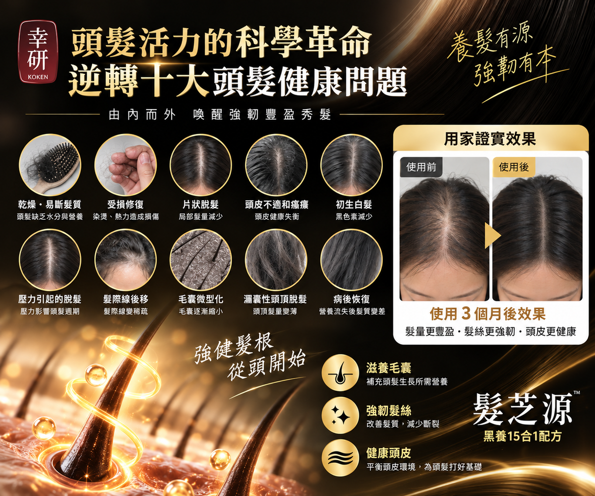 幸研 髮芝源 十大頭髮健康問題